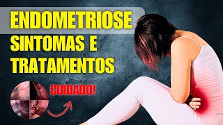 Endometriose Sintomas e Tratamentos Essenciais O Que Toda Mulher Precisa Saber [upl. by Nylrem]