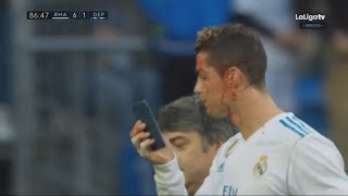 Cristiano Ronaldo Lesión en la cara  Real Madrid vs Deportivo La Coruna 71  La Liga 21012018 [upl. by Akinihs86]