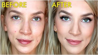 How To Cover Acne Blemishes with Makeup  LeighAnnSays [upl. by Erbe]