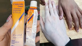 Clobevate cream for whiteninghand and foot whitening cream clobevate cream [upl. by Hiro8]