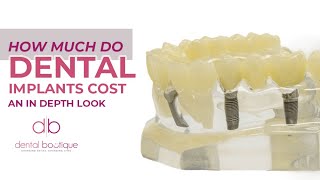 How Much Do Dental Implants Cost  An In Depth Look Dental Boutique [upl. by Warde]