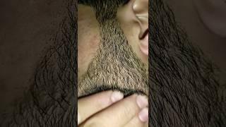 hair dresser viralshort hairremoval hairproblem [upl. by Mendy]