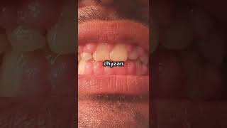 Medicines that damage your teeth and Gums [upl. by Nehgaem]