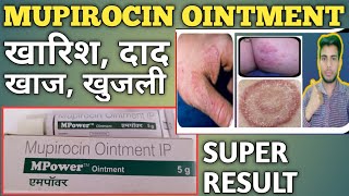 Mupirocin Ointment Ip Use In Hindi  mpower Ointment Ip  Mupirocin Ointment Use SkinAllergy [upl. by Valentijn]