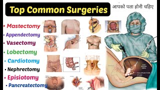 Top 15 Common Surgeries  You Should Know  mastectomy Appendectomy Lobectomyamp More [upl. by Funk40]