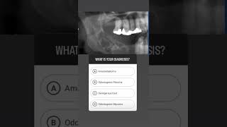 Neetmdspreparation  Ameloblastoma  Oral Path  Mcqs  IBQs Read the description dentalexams [upl. by Adal]