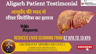 Liver Cirrhosis Treated Successfully  Inspiring Patient Testimonial with Medical Reports [upl. by Ehman171]