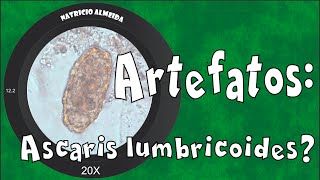 Ascaris lumbricoides ou artefato [upl. by Zaller]