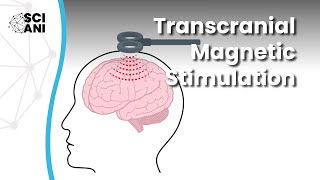 What is Transcranial Magnetic Stimulation and how can it help me [upl. by Nadoj]