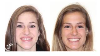 Barnett Orthondontics Changing Smiles Changing Lives [upl. by Jean]