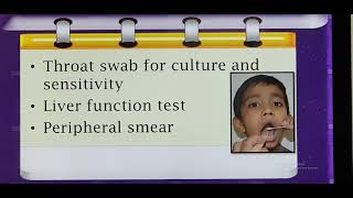 Infectious mononucleosis Hindi Patient teaching programme [upl. by Jorgan690]