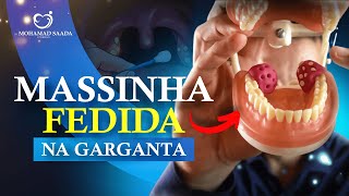 Massinha Fedida na Garganta [upl. by Avalsorim]