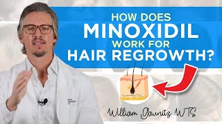 Minoxidil How Does Minoxidil Work For Hair Regrowth Results  Trichologist William Gaunitz [upl. by Neelrac]