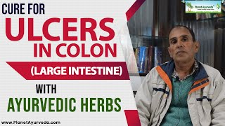 Cure for Ulcers in Colon Large Intestine with Ayurvedic Herbs [upl. by Yllah]