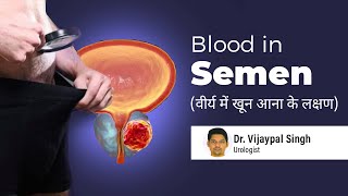 Blood in semen  सीमेन में खून आना  जानें स्पर्म में खून आने के कारण और किन लोगों को खतरा ज्यादा [upl. by Eecrad]