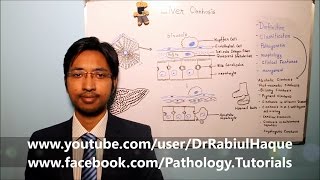 Liver Cirrhosis  Part 1 HD [upl. by Aryhs]