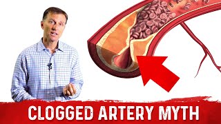 The Clogged Artery Myth – Dr Berg [upl. by Hardy]