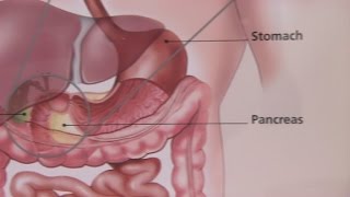 Irritable Bowel Syndrome amp Its Symptoms [upl. by Tarkany490]