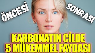 Karbonatın Cilde 5 Mükemmel Faydası [upl. by Kirst]