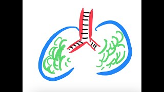 Noncardiogenic pulmonary edema [upl. by Rosabella250]