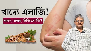 খাদ্য বা ফুড এলার্জির কারণ লক্ষণ ও চিকিৎসা  Food allergy Causes Symptoms amp Treatment in Bangla [upl. by Courtney]