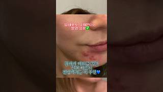 여드름 진정 할 수 있는 마르지 않는 모델링팩 추천💟 세멘팔트 입니당 여드름피부관리 에 필수💜 [upl. by Ramu]