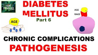 DIABETES MELLITUS  Part 6 Chronic Complications Pathogenesis [upl. by Mordy]