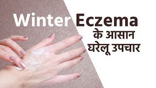 Eczema Home Remedies बदलते मौसम के कारण हो रही है एक्जिमा की समस्या तो जानें इसके घरेलू उपचार [upl. by Lellih910]