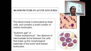 About Leucaemia in 6 minutes from prof Maksimovich Nataliya [upl. by Halullat]