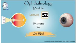 52 Red eye 13  Episcleritisscleritissubconj hemorrage Dr Wael Ophthalmology [upl. by Zoha]