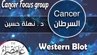 ُ ESCancer Focus Group  Western Blot [upl. by Karrie692]