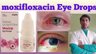 Moxifloxacin eye drop   uses side effects  dosages  composition  in hindi [upl. by Aehtla499]