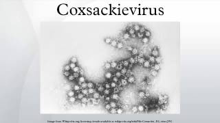 Coxsackievirus [upl. by Unni]