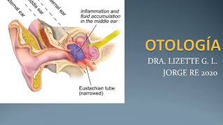 Otitis externa  Otitis media  Mastoiditis  Otoesclerosis [upl. by Chaddie]