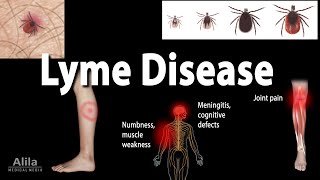 Lyme Disease Animation [upl. by Haseefan]