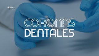 CORONAS DENTALES  DENTAL CALIFORNIA [upl. by Esilegna]