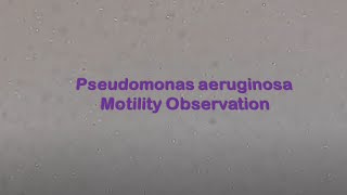 Pseudomonas aeruginosa Motility Observation [upl. by Reisinger]