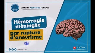 Hémorragie sousarachnoïdienne non traumatique par rupture d’anévrisme [upl. by Asertal900]