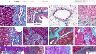 Histology stains such as eosin and hemotoxylin masons trichrome osmium tetroxide and more [upl. by Noivaz]