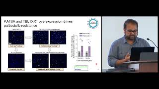 MLCB 2024 Akshat Singhal UC San Diego A deep learning model of tumor cell architecture elucidates [upl. by Notlimah]