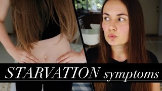 How Diets Cause EATING DISORDERS Starvation Symptoms [upl. by Adnilak]