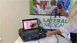 Demonstration of the new Distal Chip Videoscope [upl. by Yeldarb]