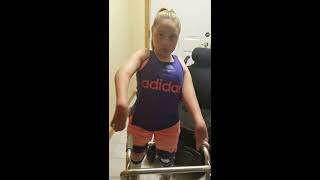 Arthrogryposis Diagnosis and Treatment  Patient Testimonial Aubrey [upl. by Ike174]