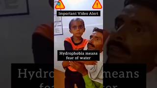 Hydrophobia in Rabies 😲 😲Fear of Water [upl. by Ahcsim]