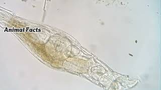 quotBdelloid Rotifer The Tiny Survivor That Defies Agingquot [upl. by Anairda]