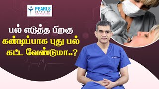 Best Options to Fix Missing Teeth After Removal  Pearls Dentistry  DrArunkumar [upl. by Arathorn807]