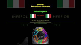 Ecocardiografia  Ipocinesia Inferolaterale E Inferiore [upl. by Verlie]