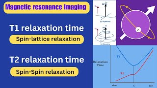 T1 Relaxation amp T2 Relaxation ll magnetic resonance imaging ll Radiography simplified [upl. by Eniroc]