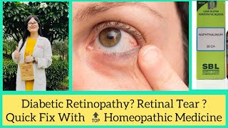 Retinal Detachment Homeopathic Treatment Homeopathic Eye Drops For All Eye Problems Torn Retina [upl. by Ogilvy886]