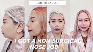 NOSE THREAD LIFT BEFORE AND AFTER  HEALING EXPERIENCE [upl. by Jadd316]